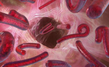 Ebola: tardive et difficile course aux traitements et vaccins