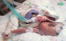Les parents d'un grand prématuré refusent l'acharnement thérapeutique