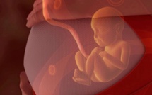 Première naissance chez une femme ayant subi une transplantation d'utérus
