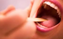 Tabac et sexe oral accroîtraient le risque de cancers buccaux
