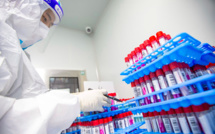 Essais fructueux pour un nouveau traitement contre le Covid-19