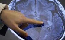 Les foetus exposés à des niveaux élevés de phtalates ont un QI inférieur