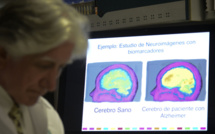 Cuba ouvre son premier centre pour malades d'Alzheimer
