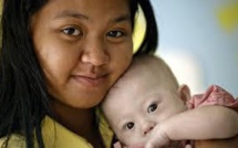 Passeport australien pour le bébé trisomique abandonné à sa mère porteuse en Thaïlande