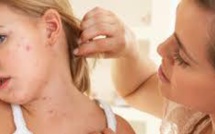 USA: des dizaines de cas de rougeole en Californie