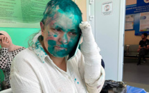 La Russie ouvre une enquête criminelle après l'attaque d'une journaliste