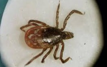 Découverte d'un nouveau virus responsable du décès d'un homme aux Etats-Unis