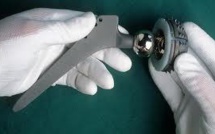 Prothèses de hanche: accord entre Johnson &amp; Johnson et des victimes aux USA