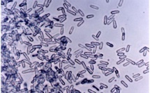 Champignon du miconia : Un généticien néo-zélandais réagit à la polémique