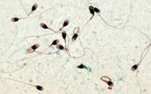 Relation entre pesticides et qualité du sperme