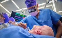 Première greffe d'un oeil complet aux Etats-Unis -- sans rétablir la vue