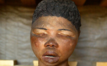 Squelettes, reliques: l'Assemblée approuve un cadre de restitution aux pays d'origine