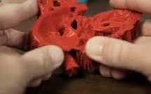 La bio-impression 3D sauve des enfants malades, une première prometteuse