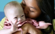 Australie: le père biologique d'un bébé trisomique accusé de vouloir mettre la main sur les dons