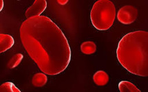 USA: un virus de l'herpès modifié efficace contre des cancers de la peau