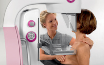 Une nouvelle thérapie ciblée confirme son efficacité contre le cancer du sein