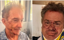 Deux touristes agressés à Papeete