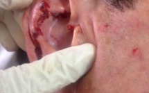 Rikitea : Il mord sa victime au visage