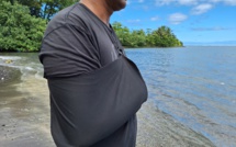 Heurté par un bateau, un pêcheur témoigne