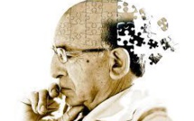 Un traitement expérimental contre Alzheimer donne des résultats prometteurs