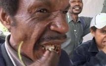 Les chiques de bétel, bombe sanitaire à retardement en Birmanie