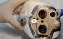 Coeur Carmat: publication de la 1ère étude scientifique sur l'essai en cours