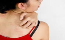 Le virus zika pourrait arriver en France métropolitaine