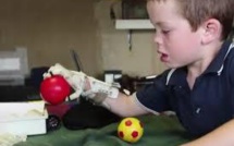 L'impression 3D veut donner une main aux enfants qui n'en ont pas