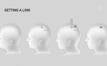 Neuralink espère implanter plusieurs patients d'ici la fin de l'année