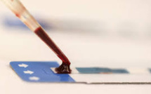 Un test sanguin pourrait prédire une rechute d'un cancer du sein