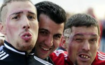 Les mauvaises dents des footballeurs britanniques nuisent à la performance