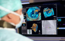 Opération cardiaque pédiatrique: première européenne à Toulouse grâce à un logiciel 3D