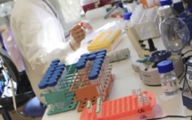 Pénurie de spécialiste en anatomo-pathologie : l'inquiétude des praticiens hospitaliers