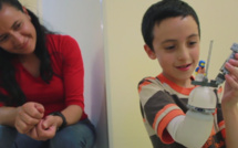 Une prothèse de bras avec des Lego récompensée au forum Netexplo