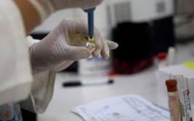 Zika: pas de tests de vaccins à grande échelle avant au moins 18 mois