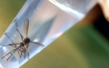 Le virus Zika découvert dans le sperme d'un homme 2 mois après l'infection (étude)