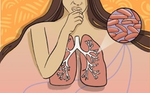 Un cas de tuberculose au lycée Raapoto