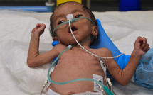 Plus de 100 ONG mettent en garde contre une "famine de masse" se propageant à Gaza