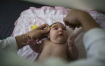 Zika: 641 cas de microcéphalie confirmés, 139 décès au Brésil