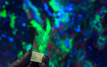 Cancer: un meilleur arsenal de médicaments "ne suffira pas", dit le président du congrès européen