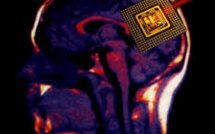 Nancy: non, les supporters ne pourront pas se faire implanter une puce sous la peau