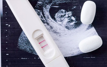 Avortement : une reconnaissance nationale qui résonne en Polynésie