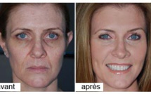 Un produit offre une "deuxième peau" et élimine les rides