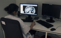 La crise de 2008 aurait engendré plus de 500.000 morts par cancer dans le monde