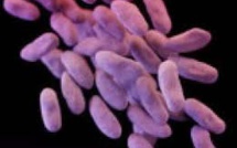 USA: les autorités mobilisées contre la propagation d'une bactérie super-résistante