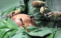 Erreur médicale fatale lors de la pose d'un anneau gastrique : peine confirmée en appel pour le chirurgien