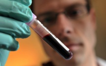 Un simple test sanguin plus efficace pour détecter des cancers