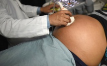 Trisomie 21: le test génétique non invasif préconisé à la place des amniocentèses