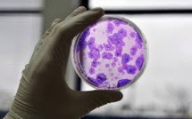 USA: 570 cliniques proposent des soins non-autorisés avec des cellules souches