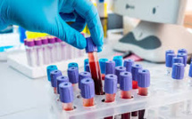 Un test sanguin expérimental prometteur pour déterminer l'usage d'antibiotique